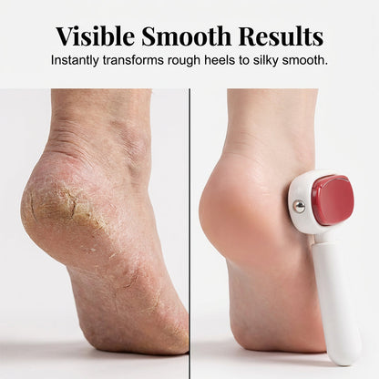 🦶✨LAST DAY 50% OFF ✨  Double Sided Stainless Steel Foot Scraper Callus Remover ✨